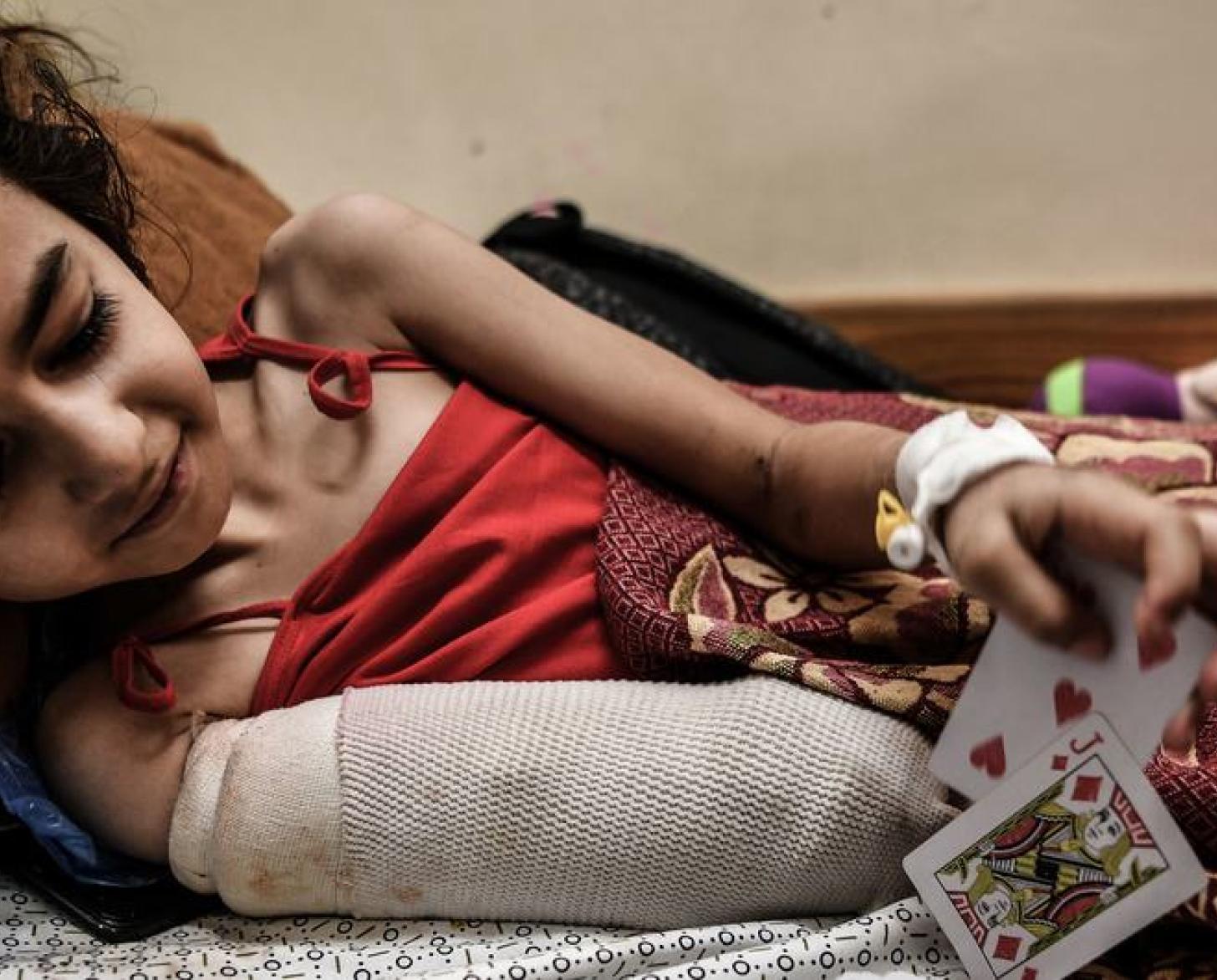 A young girl wearing a cast/covering on her arm plays with cards.